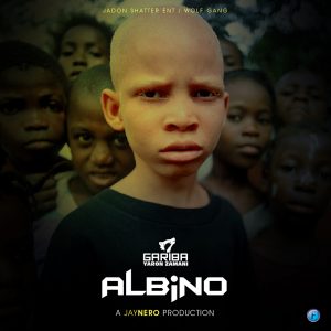 Albino by Gariba